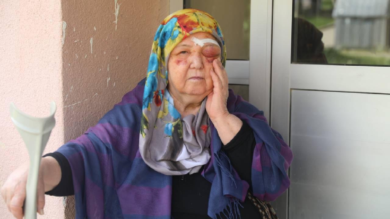Edirne'de Yaşlı Kadın Sahipsiz Köpeklerden Kaçarken Yaralandı